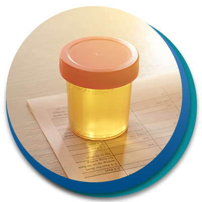 urine container for test